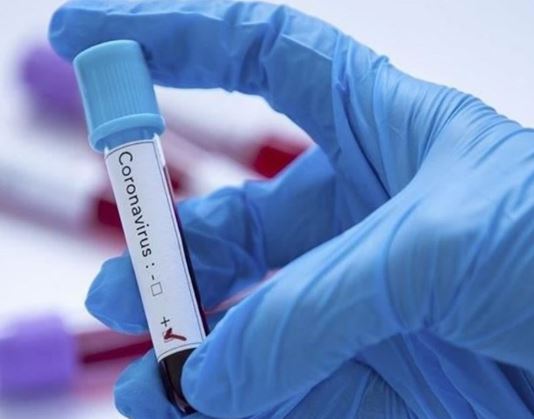 oronavirus-death-toll-April-10-2020-over-23900 Iran: coronavirus update, over 23,900 deaths, April 10, 2020