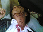 YoungManKilled Iran: Public intimidation in burial ceremony