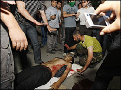 A wounded protestor of anti-government rally in Tehran – June 15, 2009 A wounded protestor of anti-government rally in Tehran – June 15, 2009