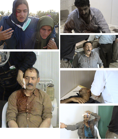 ashraf-injured-group Brutality of Iraqi forces