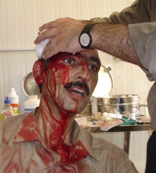 An injured man receives treatment in the hospital of Camp Ashraf after Iraqi forces attacked unarmed residents of the Camp, north of Baghdad July 29, 2009. At least twelve of the members of the People’s Mojahedin Organization of Iran (PMOI/MEK) killed in attack hundreds wounded. An injured man receives treatment in the hospital of Camp Ashraf after Iraqi forces attacked unarmed residents of the Camp, north of Baghdad July 29, 2009. At least twelve of the members of the People’s Mojahedin Organization of Iran (PMOI/MEK) killed in attack hundreds wounded.