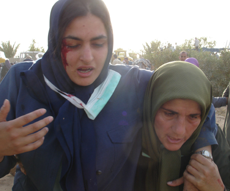 A Camp Ashraf resident injured by savage attack by Iraqi forces A Camp Ashraf resident injured by savage attack by Iraqi forces