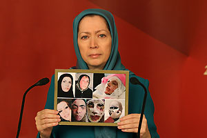 rajavi-women-acid-attack rajavi-women-acid-attack