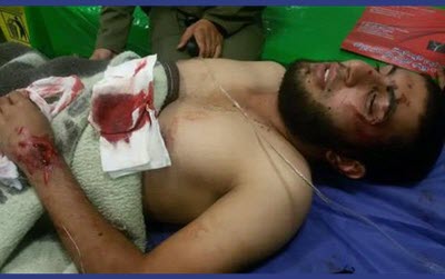 20161112212817719271281 20161112212817719271281