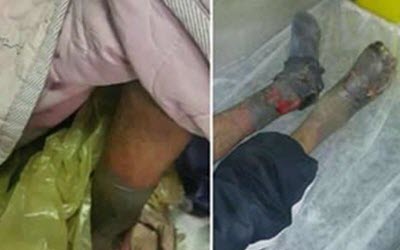 20171394533713201931 20171394533713201931