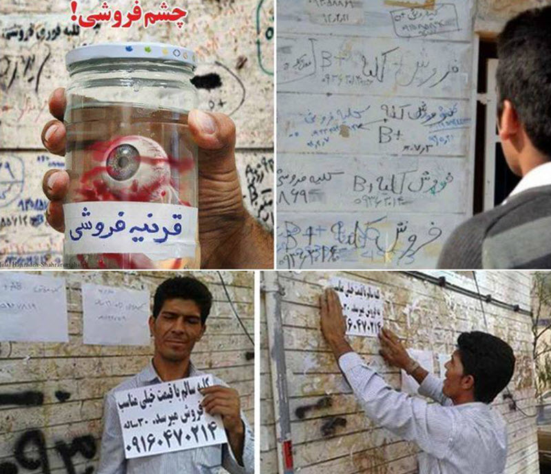 Poor-Iranians-Selling-Their-Body-Parts Poor Iranians Selling Their Body Parts